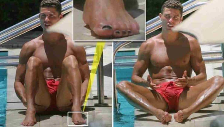 Cristiano Ronaldo neden oje sürüyor?