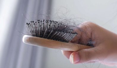 Saç Dökülmesi Neden Olur? Çözümler ve Uzman Tavsiyeleri