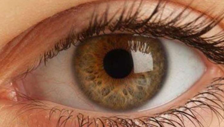 Göz Kapağı Düşüklüğü (Pitozis) Nedir?