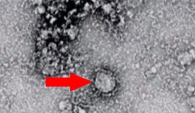 Koronavirüsün başladığı Çin’den bir virüs daha çıktı! 7 kişi hayatını kaybetti