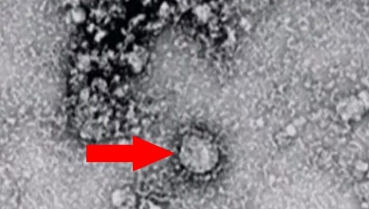 Koronavirüsün başladığı Çin’den bir virüs daha çıktı! 7 kişi hayatını kaybetti